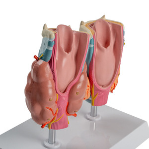 Modelo Patológico de Tiroides Humano, Hipertriatodermia, Hipotiatodermia, Sistema Endocrino, Herramienta de Enseñanza de Anatomía Médica - Product Image 3