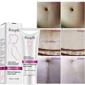 RtopR Pregnancy Scar Removal Cream Pregnant Women Pigment Correction Repair Body Gel Firming and Brightening Stretch Marks - Product Image 4