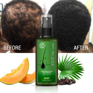 Yeni ürün saç büyüme serum saç losyonu tayland orijinal bangkok orijinal huile de coco saç dökülmesi tedavisi - Product Image 1