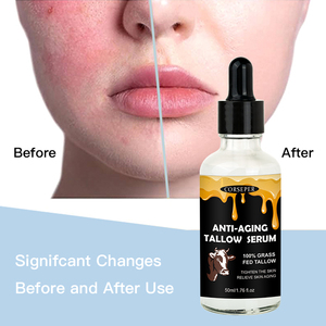 เซรั่มบำรุงผิว2025ออร์แกนิกบำรุงผิว100% หญ้าบริสุทธิ์บริสุทธิ์บาล์มช่วยให้ผิวขาวกระจ่างใสช่วยให้ผิวต่อต้านริ้วรอย - Product Image 5