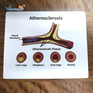 Modelo de Aterosclerosis y Trombosis de Arterias Cardiovasculares, Modelo de Obstrucción Patológica de Vasos Sanguíneos - Product Image 3