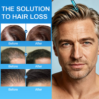 GHK-Cu AHK-Cu Haarserum Haarausfall-Prävention Kopfhautpflege Minimiert Haarausfall Verbessert Haar-Elastizität Ahk-cu Serum