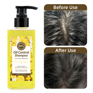 <span class=keywords><strong>Shampooing</strong></span> Contrôle Sébum Fournisseur Marque Blanche – Dissout en Profondeur les Huiles du Cuir Chevelu pour <span class=keywords><strong>Cheveux</strong></span> Gras – Laisse les <span class=keywords><strong>Cheveux</strong></span> Propres et Légers - Product Image 4