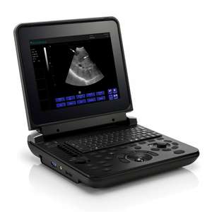 Ecógrafo Doppler Color Portátil para Animales, Ecógrafo de Bolsillo para Exámenes Veterinarios en el Lugar - Product Image 1