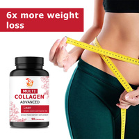 Capsules de collagène multi-sources personnalisées avec un complexe de collagène multi-sources pour favoriser une réponse saine