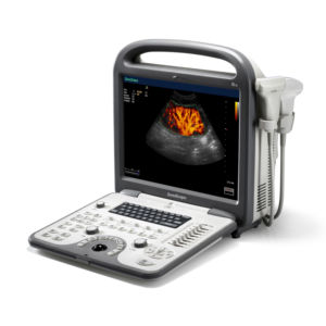 Appareil d'échographie Doppler couleur portable <span class=keywords><strong>Sonoscape</strong></span> <span class=keywords><strong>S6</strong></span> pour les personnes - Product Image 3