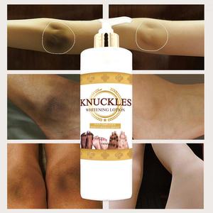 Lotion et Crème Solution Cutanée pour l'élimination <span class=keywords><strong>des</strong></span> taches foncées tenaces <span class=keywords><strong>des</strong></span> jointures, <span class=keywords><strong>des</strong></span> <span class=keywords><strong>pieds</strong></span>, <span class=keywords><strong>des</strong></span> coudes et <span class=keywords><strong>des</strong></span> genoux, et l'atténuation <span class=keywords><strong>des</strong></span> imperfections cutanées existantes - Product Image 3