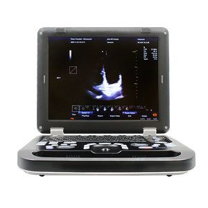 CONTEC-detector de imagen por ultrasonido, Doppler de potencia a color, tecnología de imagen cardíaca, matriz por fases, CMS1700C - Product Image 2