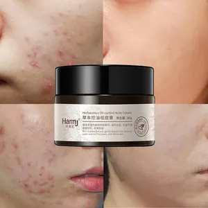 Private Label Best Herbal Treatment Removal Acne Cream Plant Extract Moist Acne Elimination Oil Control Face Cream