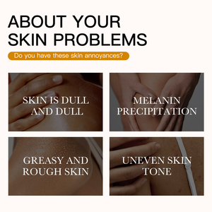 Bán Buôn Tự Nhiên Nghệ Whiteninig Nghệ Và Kojic Axit Xà Phòng Nhãn Hiệu Riêng Đốm Tối Corrector Kojic Axit Xà Phòng - Product Image 4