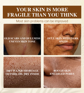 Suero Facial OEM 100ml, <span class=keywords><strong>7</strong></span> Días Antiarrugas, Blanqueador, con Colágeno, Ácido Hialurónico y Arbutina, Hidratante, Calmante, Iluminador - Product Image 2
