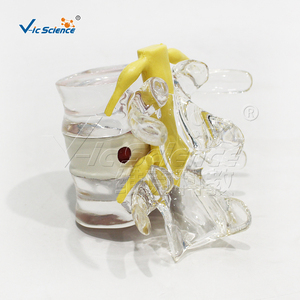 Modèle anatomique comparatif de hernie discale lombaire en PVC pour la formation en orthopédie et en laboratoire d'anatomie CE/ISO/ROHS/CNAS - Product Image 4
