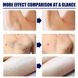 <span class=keywords><strong>Crema</strong></span> Depilatoria Maschile a Rapido Assorbimento con Erbe Naturali e Formula Indolore - Product Image 3