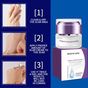 Crema OEM para el cuidado de la piel, eliminación de estrías durante el embarazo, para cicatrices abdominales y pigmentación - Product Image 2