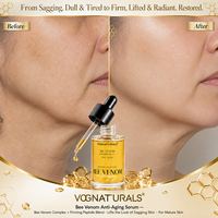 Sérum Visage au Venin d'Abeille OEM ODM 30ml – Raffermissant, Liftant, Anti-Rides, Lisse les Ridules, Nourrissant, Hydratant, Anti-Âge