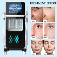 Machine d'hydrodermabrasion Hidrafacial stable à 17 fonctions, machine de formation Alice Beauty Academy, machine pour la peau, revitalisation de la peau