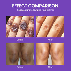 Crème Visage Correctrice Anti-Taches JMFREE OEM 7 Jours, Forte Action Blanchissante, Élimination des Taches de Rousseur, Vitamine B5 E, Collagène de Perle - Product Image 3