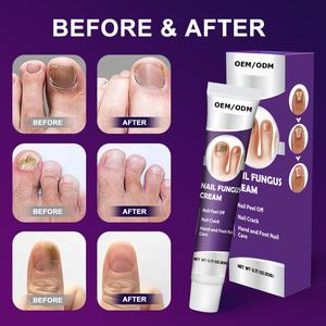 Neue Trendprodukte für Nagelreparatur-Creme Gesundheitspflege für Zehennägel Pflegende Salbe Entfernt Nagelbeschädigungen - Product Image 4
