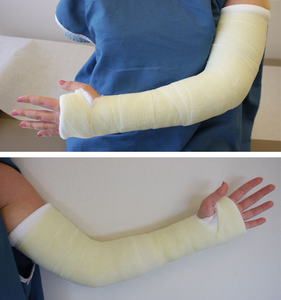 Cinta de Yeso Ortopédica de Fibra de Vidrio para <span class=keywords><strong>Hospital</strong></span>, 15 cm x 4.5 m - Rollo de Férula con Certificación CE ISO13485 para Inmovilización de Fracturas - Product Image 3