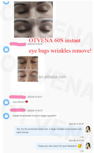 Crema para Ojos OTVENA - 100% Efectiva contra la Hinchazón y las <span class=keywords><strong>Ojeras</strong></span>, Reafirma la Piel del Contorno de Ojos en 60 Segundos - Product Image 3