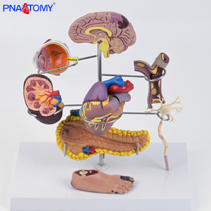 Modelo Anatómico Médico <span class=keywords><strong>de</strong></span> Diabetes <span class=keywords><strong>de</strong></span> 8 Partes, Desmontable, <span class=keywords><strong>de</strong></span> PVC, con Globo Ocular, Corazón, Riñón, Vasos Sanguíneos y Pie, con Patología - Product Image 3