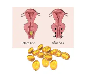 도매 가장 효과적인 질 최고의 강화 젤 V 꽉 알약 클릭 Yoni 해독 허브 알약