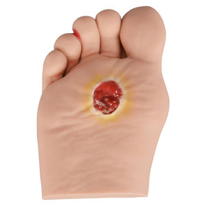 IPA medis <span class=keywords><strong>Diabetes</strong></span> Model Pegboard anak, untuk demonstrasi Pendidikan - Product Image 3