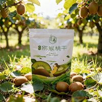 Sachets Doypack personnalisés en plastique Mylar avec fermeture éclair pour emballage alimentaire