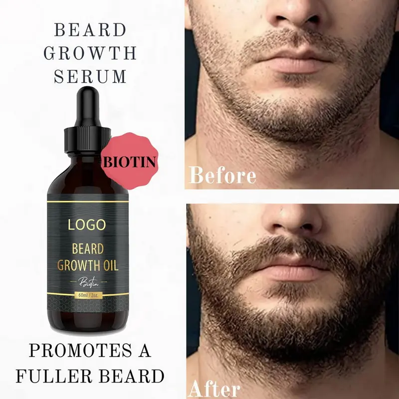 Aceite para el crecimiento de la barba de etiqueta privada, espesante y acondicionador, aceite para la barba para el crecimiento de los hombres, suero de crecimiento de barba Natural para el cuidado facial del hombre