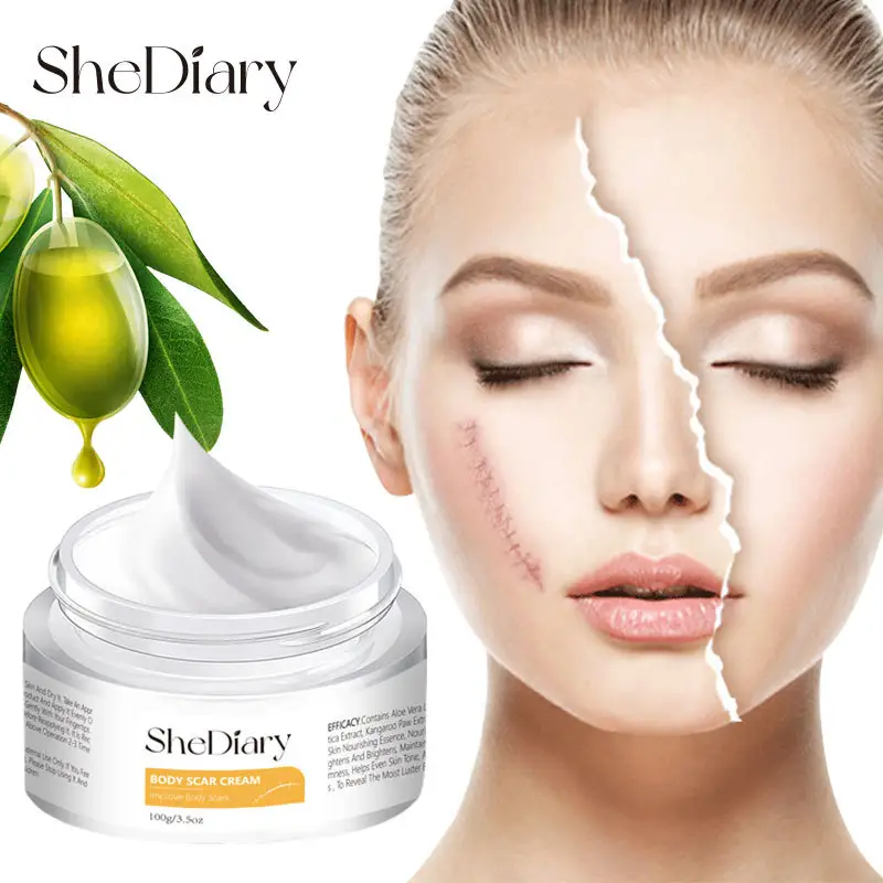 Oem Anti Acne Litteken Striae Verwijderaar Crème Huidverzorging Reparatie Acne Vlekken Acne Verwijdering Behandeling Whitening Gezicht Body Cream