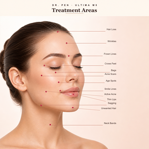 Stylo de Microneedling Sans Fil et Filaire <span class=keywords><strong>Dr</strong></span>.<span class=keywords><strong>pen</strong></span> Ultima M5 <span class=keywords><strong>M7</strong></span>, Réglable de 0,25 à 2,5 mm, pour Soins du Visage à Domicile ou en Salon, Appareil de Beauté - Product Image 2