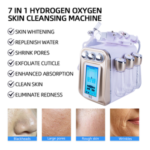 Máquina de Limpieza Facial Hidratante Antiarrugas – Equipo 7 en 1 para el Cuidado de la Piel con Agua para Salón de Belleza - Product Image 6