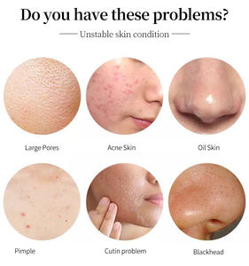 KORMESIC - Suero Facial con Vitamina C y A, 30 ml, Hidratante, Antienvejecimiento, Antiarrugas, Reafirmante, Suavizante, Antiacné, Iluminador - Product Image 4