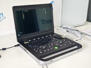 Système d'échographie Doppler couleur portable et d'imagerie diagnostique très demandé pour usage vétérinaire - Product Image 5