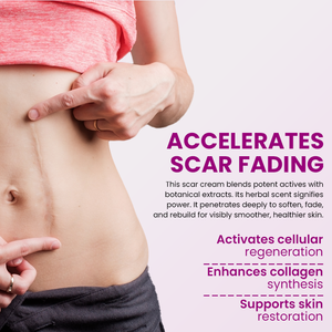 <span class=keywords><strong>ครีม</strong></span>บำรุงผิวหน้าต่อต้านริ้วรอยด้วยกรดไฮยาลูโรนิก เชียบัตเตอร์ และกรดแลคโตไบโอนิก สำหรับ<span class=keywords><strong>ลด</strong></span><span class=keywords><strong>รอย</strong></span>แผลเป็นจาก<span class=keywords><strong>สิว</strong></span>และ<span class=keywords><strong>รอย</strong></span>แตกลาย - Product Image 4