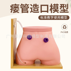 Modèle de soins pour stomies fistulaires ; Modèle d'entraînement aux fistules ; Colostomie ; Modèle d'iléostomie - Product Image 1
