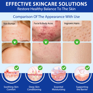 YECUCE 120g Crème Traitante Anti-Démangeaisons et Renouvellement Cutané pour la Foliculite, Soin Anti-Acné pour Cuir Chevelu, Visage et Corps, Contre les Rougeurs et les Bosses - Product Image 2