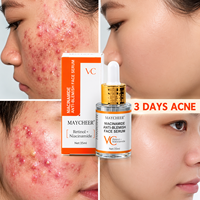 Gel Réparateur Rapide et Efficace Contre les Cicatrices d'Acné et les Taches, Lisse la Peau, Resserre les Pores, Sérum Anti-Acné OEM ODM