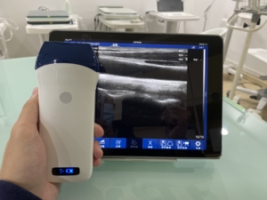 Sonde linéaire sans fil DMU37 à 128 éléments, la plus vendue, avec Doppler couleur pour MSK/Anesthésie/Vascularisation et Hôpitaux - Product Image 4