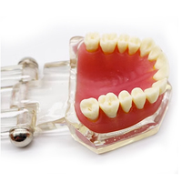 Modelo de dentadura oral anatómico para entrenamiento dental, dentadura extraíble estándar, modelos typodont de estudio dental