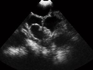 Appareil d'échographie vétérinaire Midray pour diagnostic abdominal par échographie - Product Image 6