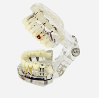 Implants dentaires pathologiques en PVC transparent avec modèles de nerfs dentaires à des fins d'enseignement médical et dentaire CE/ISO