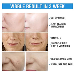 แผ่นเช็ดทำความสะอาดผิวหน้าสูตรกรดซาลิไซลิก/กรดไกลโคลิก สำหรับผลิตภัณฑ์ดูแลผิวแบบ OEM/ODM แบรนด์ส่วนตัว - Product Image 6