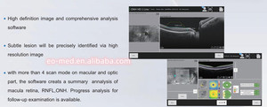 Máquina OCT Oftálmica Ó<span class=keywords><strong>ptica</strong></span> Totalmente Automática Más Económica, Tomografía de Coherencia Ó<span class=keywords><strong>ptica</strong></span> OCT-50 - Product Image 6