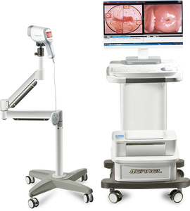 2025 <strong>New</strong> Kernel <strong>Colposcope</strong> Manufactures Vaginoscope Digital Video <strong>Colposcope</strong> for Gynecology Colposcopy - Product Image 5