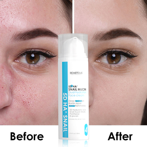 NEW 5D Hyaluronic Acid Wrinkles Anti-aging Snail Anti Age <strong>Moisturising</strong> Whitening Face Moisturizing Antiwrinkle Moisterizer Cream - Product Image 3