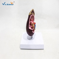 Modèle anatomique de rein humain démontable en PVC pour la néphrologie clinique et la démonstration pédagogique en anatomie CE/ISO/ROHS/CNAS