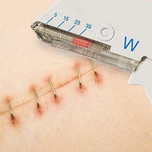 Nieuwe Coming Flexibele En Handige Wegwerp Eenmalig Gebruik Wegwerp Huid Nietmachine - Product Image 3