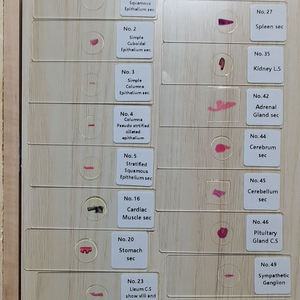 Ensemble de 100 lames de microscope préparées sur le thème de la pathologie humaine, utilisées par les médecins et les étudiants en médecine - Product Image 6