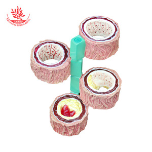 Modèle vasculaire, spécimen vasculaire pathologique en quatre étapes, démonstration de communication médecin-patient en cardiologie, vasculaire - Product Image 1